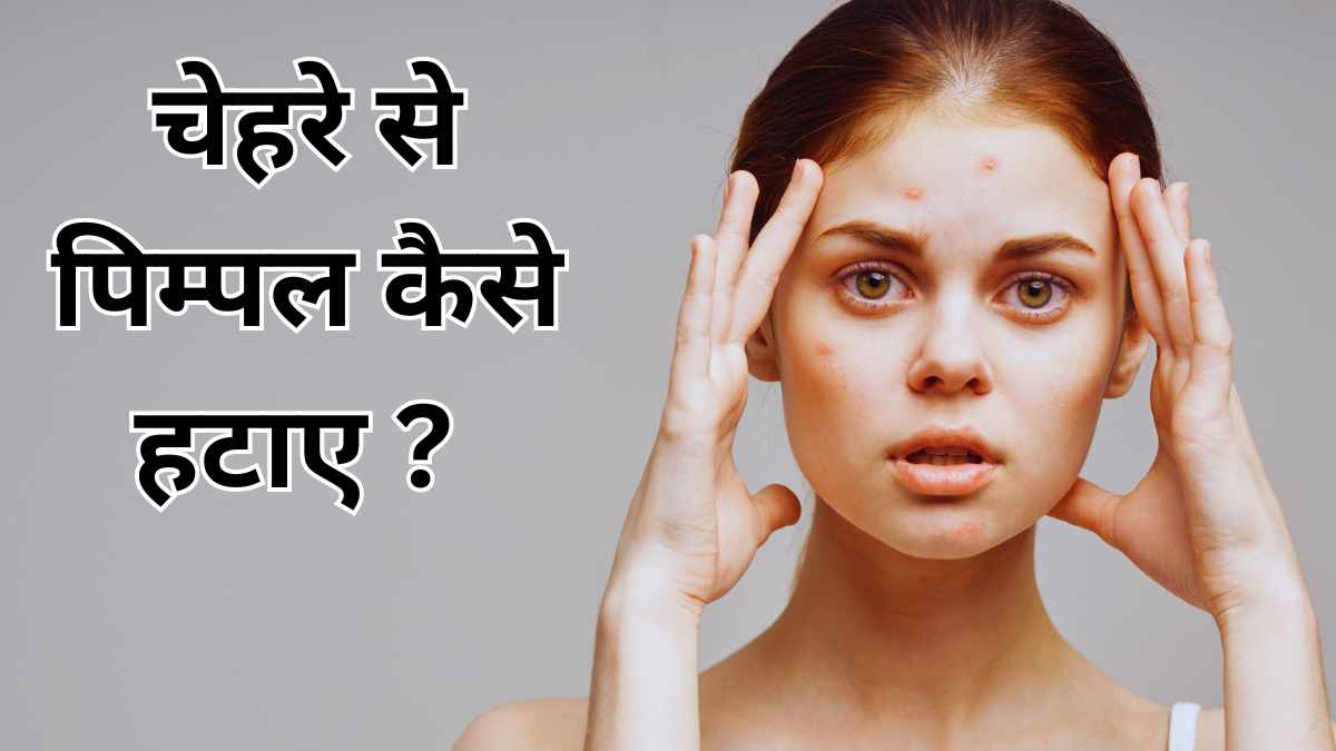 Chehre Se Pimple Kaise Hataye